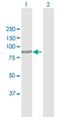 Inositol Polyphosphate-5-Phosphatase B antibody, H00003633-D01P, Novus Biologicals, Western Blot image 