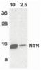 Neurturin antibody, PA5-19867, Invitrogen Antibodies, Western Blot image 