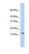 G Protein Subunit Gamma Transducin 2 antibody, NBP1-56676, Novus Biologicals, Western Blot image 