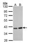 Protein Phosphatase 1 Catalytic Subunit Gamma antibody, PA5-21671, Invitrogen Antibodies, Western Blot image 