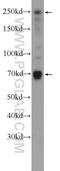 Eukaryotic Translation Initiation Factor 4 Gamma 3 antibody, 11281-1-AP, Proteintech Group, Western Blot image 