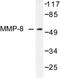 Matrix Metallopeptidase 8 antibody, AP06235PU-N, Origene, Western Blot image 