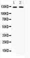 CD11b antibody, PA5-79534, Invitrogen Antibodies, Western Blot image 