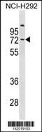 Collagen Type IX Alpha 3 Chain antibody, 60-870, ProSci, Western Blot image 