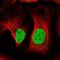 ATPase H+ Transporting V1 Subunit D antibody, NBP2-49254, Novus Biologicals, Immunofluorescence image 