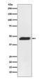 Mitogen-Activated Protein Kinase Kinase 2 antibody, M00996, Boster Biological Technology, Western Blot image 