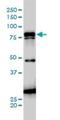 Junction Plakoglobin antibody, H00003728-M01, Novus Biologicals, Western Blot image 