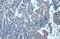 Matrix Metallopeptidase 7 antibody, GTX104658, GeneTex, Immunohistochemistry paraffin image 