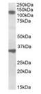 CARP-1 antibody, orb20384, Biorbyt, Western Blot image 