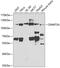 DNA Methyltransferase 3 Alpha antibody, GTX55596, GeneTex, Western Blot image 
