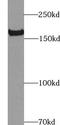 Terminal uridylyltransferase 7 antibody, FNab09611, FineTest, Western Blot image 