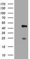 Centromere protein H antibody, TA504306, Origene, Western Blot image 