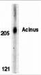 Apoptotic Chromatin Condensation Inducer 1 antibody, 2217, ProSci, Western Blot image 