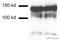 Neurotrophic Receptor Tyrosine Kinase 1 antibody, ab8871, Abcam, Western Blot image 