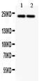 Dicer 1, Ribonuclease III antibody, RP1044, Boster Biological Technology, Western Blot image 