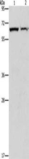 Cystathionine-Beta-Synthase antibody, CSB-PA205503, Cusabio, Western Blot image 