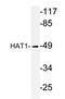 Histone acetyltransferase type B catalytic subunit antibody, AP20234PU-N, Origene, Western Blot image 