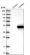 Inositol Polyphosphate-5-Phosphatase A antibody, NBP1-89361, Novus Biologicals, Western Blot image 