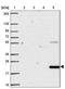 Phospholipase A2 Group XIIB antibody, NBP2-31685, Novus Biologicals, Western Blot image 