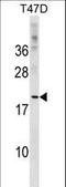 C-Type Lectin Domain Family 4 Member D antibody, LS-C159366, Lifespan Biosciences, Western Blot image 