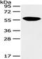 Serine/threonine-protein kinase PINK1, mitochondrial antibody, TA350783, Origene, Western Blot image 