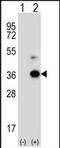 Angiopoietin Like 7 antibody, PA5-71736, Invitrogen Antibodies, Western Blot image 