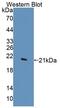 Deoxythymidylate Kinase antibody, LS-C663416, Lifespan Biosciences, Western Blot image 
