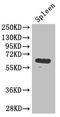 Glycerol Kinase antibody, CSB-PA300097LA01HU, Cusabio, Western Blot image 