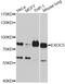 Exocyst Complex Component 5 antibody, A9282, ABclonal Technology, Western Blot image 