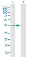 Aspartate Beta-Hydroxylase Domain Containing 1 antibody, H00253982-B01P, Novus Biologicals, Western Blot image 