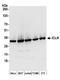 Methylosome subunit pICln antibody, A304-521A, Bethyl Labs, Western Blot image 