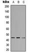 SPT3 Homolog, SAGA And STAGA Complex Component antibody, GTX56121, GeneTex, Western Blot image 