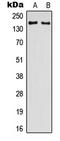 Glutamate Ionotropic Receptor NMDA Type Subunit 2D antibody, LS-C358762, Lifespan Biosciences, Western Blot image 