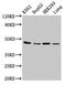 Oxoeicosanoid Receptor 1 antibody, LS-C673460, Lifespan Biosciences, Western Blot image 