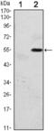 Eukaryotic Translation Initiation Factor 2 Alpha Kinase 3 antibody, abx011890, Abbexa, Enzyme Linked Immunosorbent Assay image 