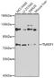 Transmembrane 9 Superfamily Member 1 antibody, A13964, Boster Biological Technology, Western Blot image 