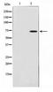 Interleukin 1 Receptor Associated Kinase 3 antibody, TA347743, Origene, Western Blot image 
