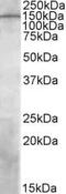 Phosphatidylinositol-3,4,5-Trisphosphate Dependent Rac Exchange Factor 1 antibody, PA5-19181, Invitrogen Antibodies, Western Blot image 