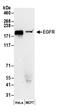 EGFR antibody, A300-387A, Bethyl Labs, Western Blot image 