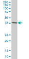 TARBP2 Subunit Of RISC Loading Complex antibody, LS-C139079, Lifespan Biosciences, Western Blot image 