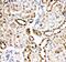 Heat Shock Protein Family A (Hsp70) Member 8 antibody, PA1816, Boster Biological Technology, Immunohistochemistry paraffin image 