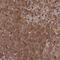 Phosphopantothenoylcysteine Decarboxylase antibody, PA5-61065, Invitrogen Antibodies, Immunohistochemistry paraffin image 