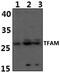 Transcription Factor A, Mitochondrial antibody, PA5-75926, Invitrogen Antibodies, Western Blot image 