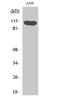 Hepatocyte Growth Factor-Regulated Tyrosine Kinase Substrate antibody, A01174Y216-1, Boster Biological Technology, Western Blot image 