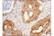 Carbamoyl-Phosphate Synthetase 2, Aspartate Transcarbamylase, And Dihydroorotase antibody, 67235S, Cell Signaling Technology, Immunohistochemistry paraffin image 