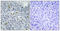 DNA Topoisomerase II Alpha antibody, A00953S1106-1, Boster Biological Technology, Immunohistochemistry frozen image 
