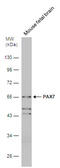 Paired Box 7 antibody, GTX100702, GeneTex, Western Blot image 