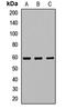 Interleukin 21 Receptor antibody, orb412614, Biorbyt, Western Blot image 