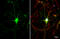 ATPase H+ Transporting Accessory Protein 2 antibody, GTX114169, GeneTex, Immunofluorescence image 