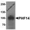 PHD Finger Protein 14 antibody, PA5-72775, Invitrogen Antibodies, Immunofluorescence image 